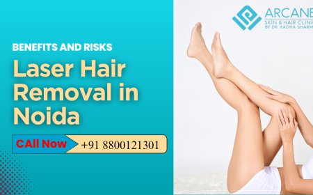 Benefits and Risks of Facial Laser Hair Removal