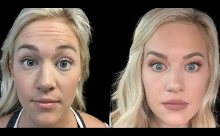 The Best Aesthetic Clinic in Dubai for Customized Skin Treatments