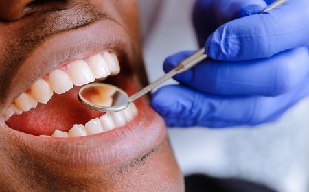 The Importance of Professional Dental Cleaning Services for Your Oral Health