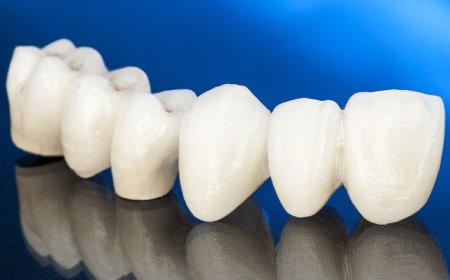 Sedation Dentistry: The Comfortable Solution to Dental Anxiety