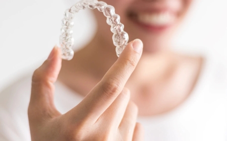 Transform Your Smile with Invisalign in Kingman