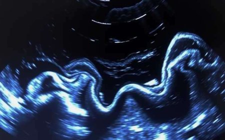 Convenient and Accurate Heart Imaging: Find the Best Portable Echo Near Me with Medex Diagnostic Services   