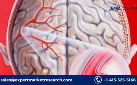 North America Intracranial Aneurysm Market: Demand Forecast and Market Growth (2034)