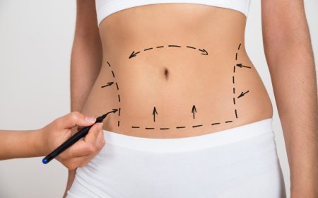 Best Liposuction Doctors in Dubai Share Their Vision