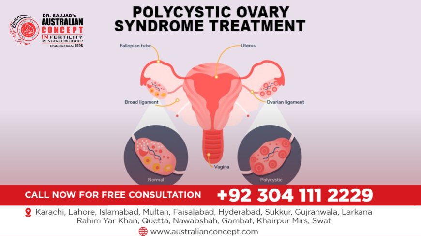 What are the treatment options for PCOS in Lahore