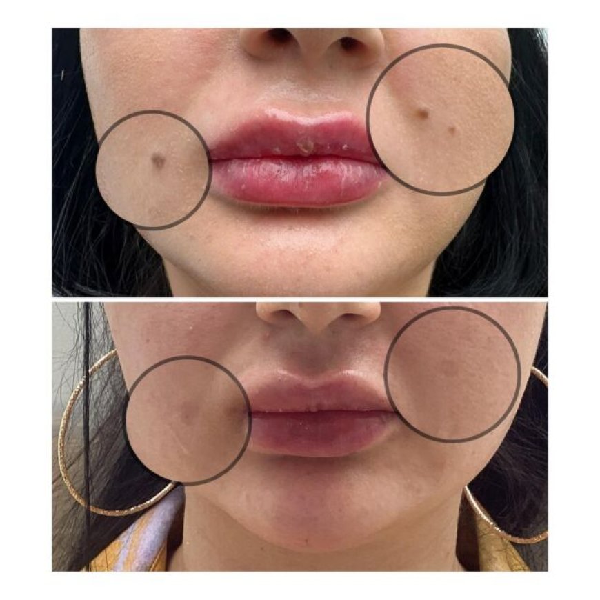 Your Path to Radiant Skin Why a Richmond Skin Clinic is Your Best Bet